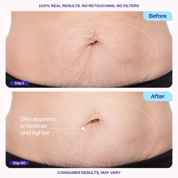 Feature product image